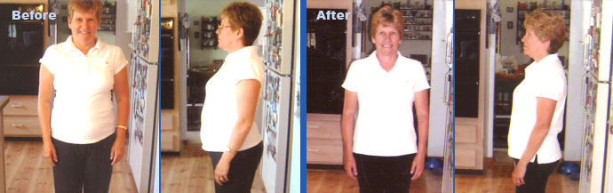 Before and After HCG Weightloss